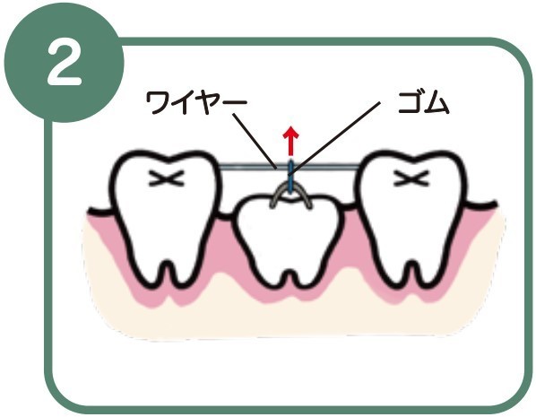 墨田区鐘ヶ淵の歯医者カルミアデンタルクリニック　2